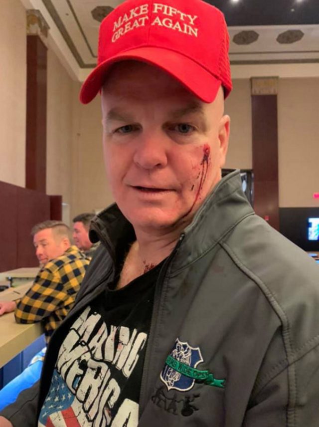 Daniel Sprague Retired NYPD Officer Says Woman Punched Him In Face Left It Bloody On His Birthday Over Red Cap That Looked Like MAGA Hat